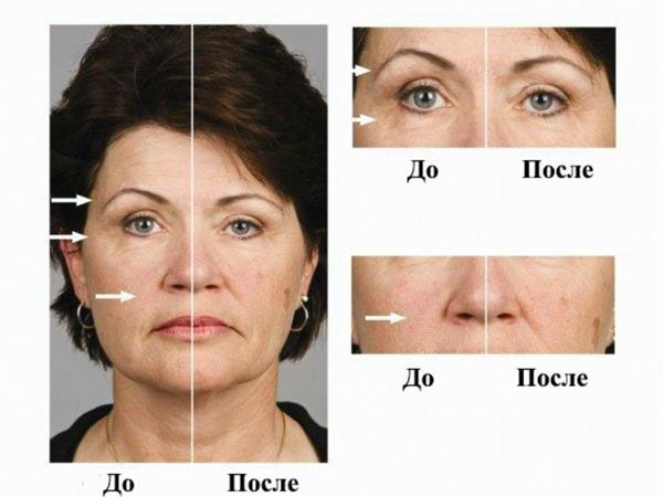 микротоки