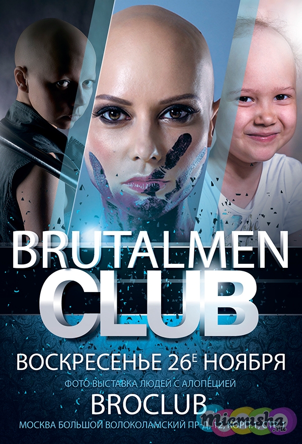 алопеция