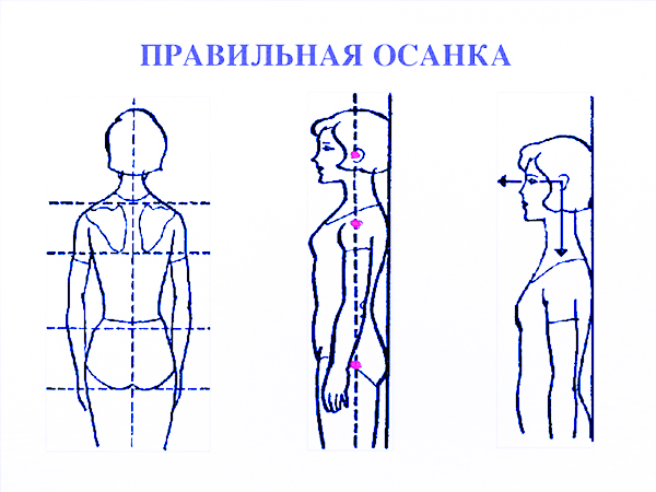 правильная осанка